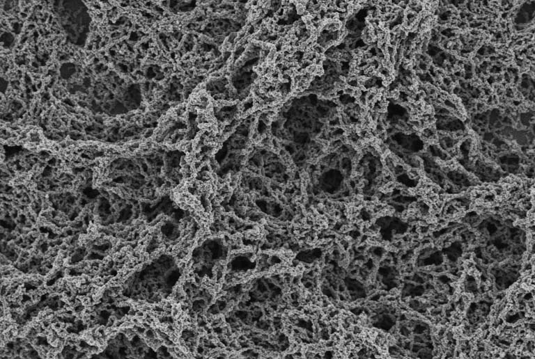field of overlapping long thin chains of spongy-looking structures