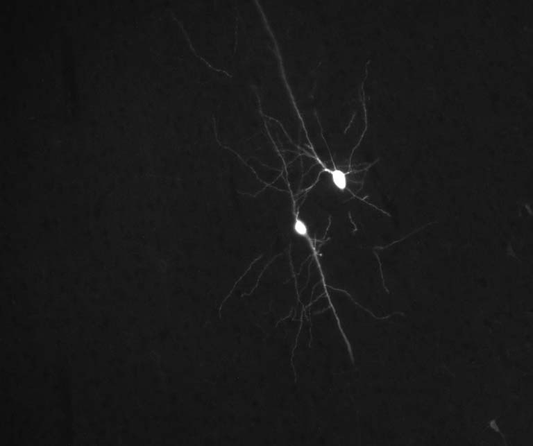 white neurons on a black field