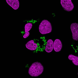 close up view of purple cells with green clusters around and between three of them