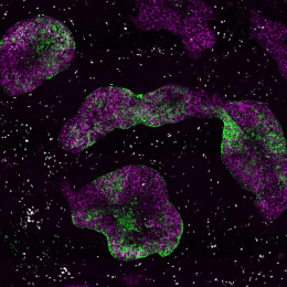 green and purple cell clusters speckled with white stretch like clouds across a black field