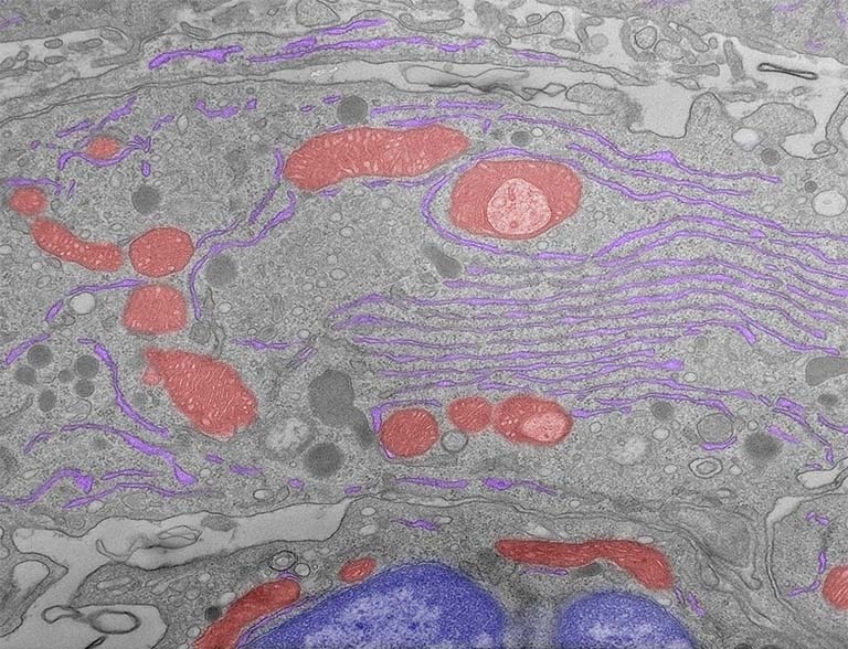 cells in grayscale with false color highlights in pink, purple, and indigo