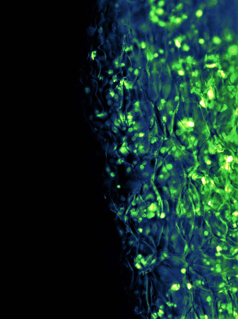 cells (in green) disperse against a black background