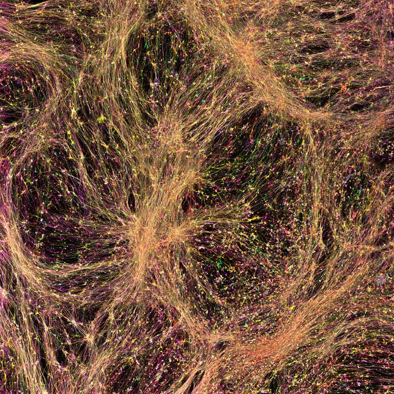 glowing orange neurons form a pale feathery string-like web against a black background