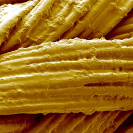 cords of bundled fibers woven together, colored yellow