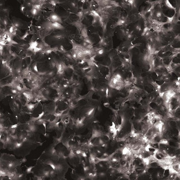 wide field view of cells in grayscale, with high concentrations of white nuclei in the corners