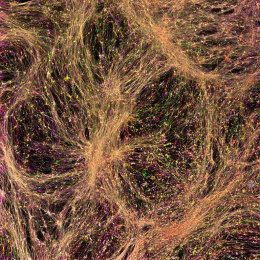 glowing orange neurons form a pale feathery string-like web against a black background
