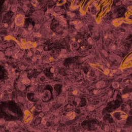 round orange- and dark pink-colored cells cluster across a wide horizontal field 