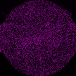 a full filled-in circle of thin mesh-like magenta cells against a black background